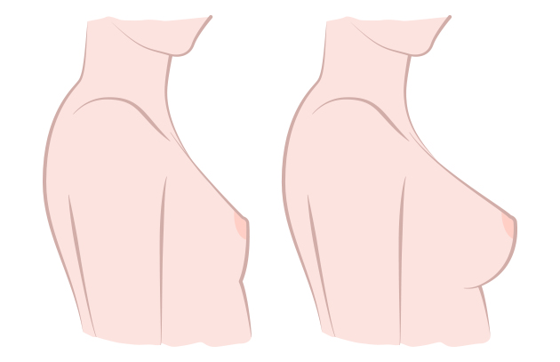 breast size comparison